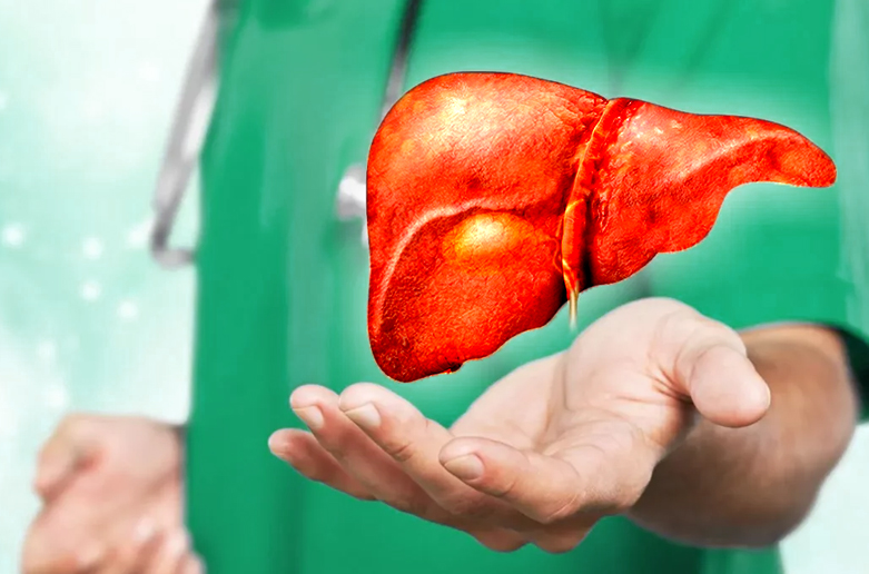 fatty liver image