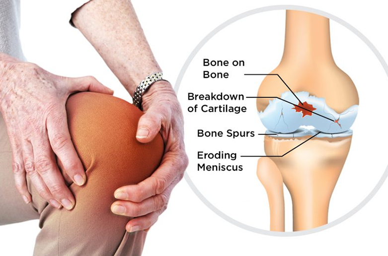 Joint pain